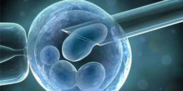 体外受精-胚胎移植（IVF-ET）